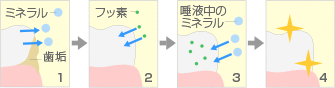 フッ素塗布